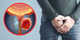 Cáncer de próstata: 7 peruanos pierden la vida cada día