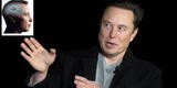 Elon Musk un pase adelante: Estaría preparando una solución innovadora para las personas amputadas
