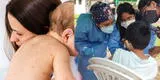 Surco: Minsa alerta sobre caso de sarampión en bebé de 10 meses y promueve la vacunación
