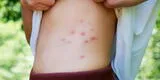 Denuncian plaga de pulgas en colegio de SJL: Madres exigen una solución por la salud de los niños
