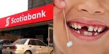 ¿Cómo participar de la campaña del diente de leche de Scotiabank si no eres cliente del banco?