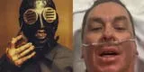 Sid Wilson, DJ de Slipknot, es hospitalizado tras sufrir quemaduras en su rostro y brazos: “Una explosión en la cara”