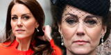 ¿Por qué Kate Middleton tiene una cicatriz en la cabeza? Conoce su origen y significado