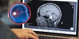 El implante cerebral que apaga la depresión más grave en segundos: conoce la cirugía que está cambiando vidas