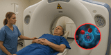 ¡Inesperado riesgo! Abuso de tomografías computarizadas podría aumentar miles de casos de cáncer, según estudio