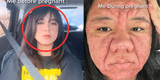 Mujer muestra cómo el embarazo transformó su rostro y terminó con su autoestima