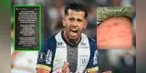 Jugador de Alianza Lima es acusado de agredir a modelo y este se pronuncia: "Tomaré las medidas legales"