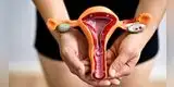 Estos superalimentos ayudan a prevenir miomas, endometriosis y ovarios poliquísticos