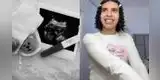 Tiktoker Valentino Palacios SORPRENDE al anunciar su 'embarazo' y fans quedan en SHOCK: "La familia se agranda"