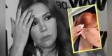 Magaly Medina REVELA que perdió SENSIBILIDAD en su oreja tras realizarse cirugía facial en Argentina: "No pensaba hablar..."