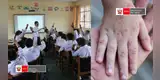 Minedu y Minsa activan protocolos tras más de 140 casos de virus Coxsackie en colegios: padres deberán cumplir medidas