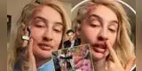 Fran Maira, exsaliente chilena de Austin Palao, reaparece con severos golpes tras sufrir agresión y enciende las alarmas