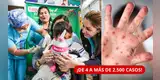 ¡SARAMPIÓN SE DISPARA EN PERÚ! Casos pasan de 4 a más de 2.500 en un año | ESTAS REGIONES ESTÁN EN ALERTA