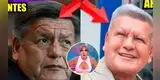 Magaly Medina queda en shock con el NUEVO ROSTRO de César Acuña tras someterse a unos ‘RETOQUITOS’ y lanza polémico comentario: “Le han hecho…”