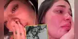 Natalia Segura vivió TREMENDO SUSTO tras el FUERTE ACCIDENTE de su hijo: “El corazón se me salía del cuerpo”