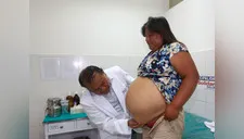 Carapongo: damnificada vivía con hernia de 30 centímetros en el vientre