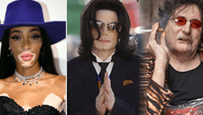 Michael Jackson y algunos famosos que aprendieron a vivir con Vitíligo [FOTOS]