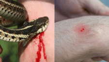 ¿Qué hacer si me muerde una serpiente?