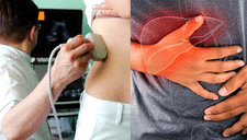 Cáncer de hígado: Así puedes reconocer los síntomas y qué tratamiento llevar