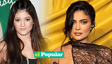 Kylie Jenner:¿De qué operación se arrepiente y qué problemas tuvo por años?