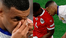 Kylian Mbappé se perdería la Eurocopa tras sufrir una grave fractura: el jugador será operado