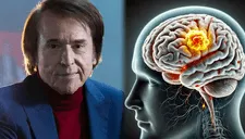 ¿Qué es linfoma cerebral y cuáles son los síntomas del tumor que padece el cantante Raphael?