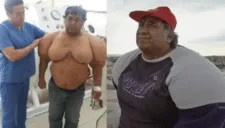 El buzo peruano "inflado" revela su DESGARRADOR accidente: 11 años con un cuerpo fuera de lo normal