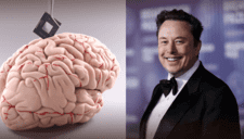 ¿El fin de la ceguera? Elon Musk promete devolver la visión con chips cerebrales de Neuralink