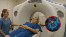 ¡Inesperado riesgo! Abuso de tomografías computarizadas dispararía miles de casos de cáncer, según estudio