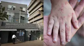 ¿Se suspenderán las clases? Perú registra más de 300 contagios de virus Coxsackie en colegios: esto dice Minedu