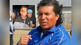 El DT acusa al presidente de Fuerza Minera, Omar Sucasaire, y a sus hermanos Ramiro y Serapio de tomar represalias porque el equipo fue eliminado de la Copa Perú. 