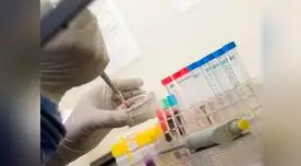 Prueban en Guinea test para diagnosticar ébola en 15 minutos.