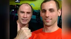 Tiene muy poco cabello.