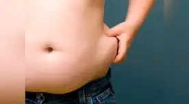 Mal nutrición y la genética son las causas de la obesidad