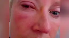 La víctima dijo que la falta de visión fue "bastante inmediata". | FOTO: referencial