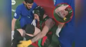 Krayg Peña sufrió grave lesión