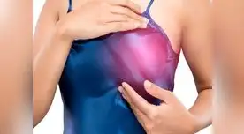 En el mundo diversas campañas de prevención son lanzadas cada año para que las mujeres se examinen y detecten a tiempo esta enfermedad