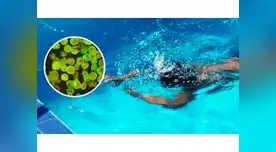 Ameba comecerebros afecta a niña de año y 11 meses de nacida