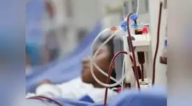 Mujer falleció por el Síndrome Guillian Barré en Trujillo 