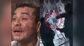 Estadounidense arrojó ácido a peruano en medio de una discusión 