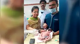 Doctores advirtieron que los gemelos nacerían unidos pero no se imaginaron que compartirían un solo cuerpo Doctores advirtieron que los gemelos nacerían unidos pero no se imaginaron que compartirían un solo cuerpo