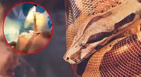 Extraen una serpiente de la garganta de una mujer