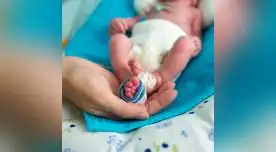 Se considera a un niño prematuro a todo aquel que nace antes de las 37 semanas de gestación.