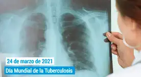 La tuberculosis es causada por una bacteria llamada Mycobacterium tuberculosis atacan a los pulmones, pero también puede afectar a otras partes del cuerpo.