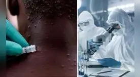 El primer gran brote de la viruela de los monos en EE. UU. fue detectada en 2003, pero recientemente se ha detectado un nuevo caso y otros posibles contagios.