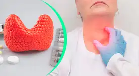 El cáncer de tiroides se produce cuando las células de la glándula tiroidea comienzan a crecer sin control.