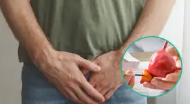 Este tipo de cáncer avanza con rapidez. Este tipo de cáncer avanza con rapidez.