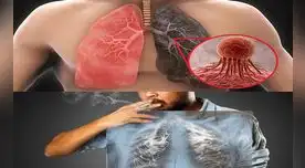 Deje el cigarro, este es un aliado del cáncer de pulmón. Deje el cigarro, este es un aliado del cáncer de pulmón.