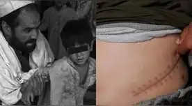 En Afganistán venden hasta sus órganos vitales para alimentar a su familia ante la crisis que vive el país.