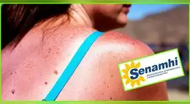 La entidad del tiempo alertó que algunos distritos alcanzaron radiación ultravioleta alta, muy alta y extremadamente alta.